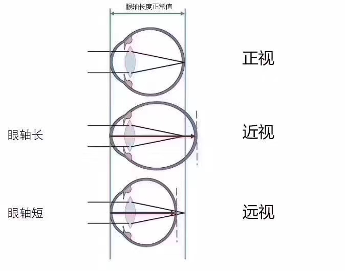 共同呵护好孩子的眼睛，让他们拥有一个光明的未来